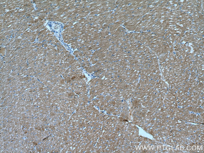 Myozenin 2 Antibody in Immunohistochemistry (Paraffin) (IHC (P))