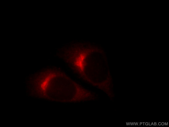 COPE Antibody in Immunocytochemistry (ICC/IF)