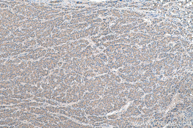 PRUNE2 Antibody in Immunohistochemistry (Paraffin) (IHC (P))