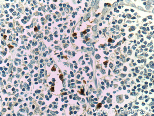 LILRA2 Antibody in Immunohistochemistry (Paraffin) (IHC (P))