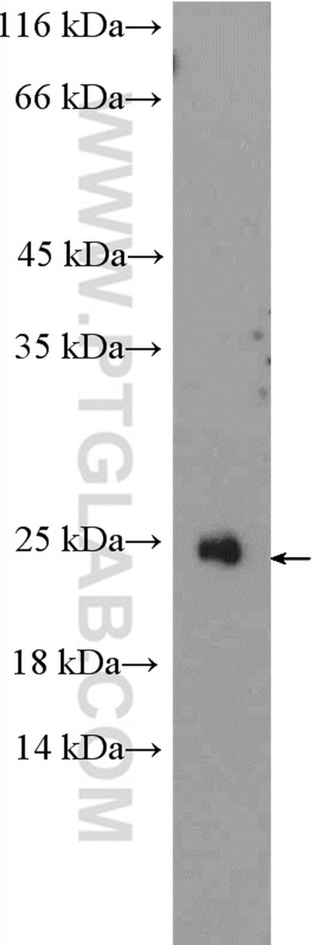 RAX2 Antibody in Western Blot (WB)