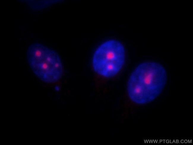 UTP14A Antibody in Immunocytochemistry (ICC/IF)