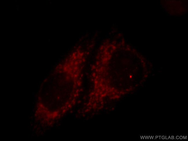 TIMM9 Antibody in Immunocytochemistry (ICC/IF)