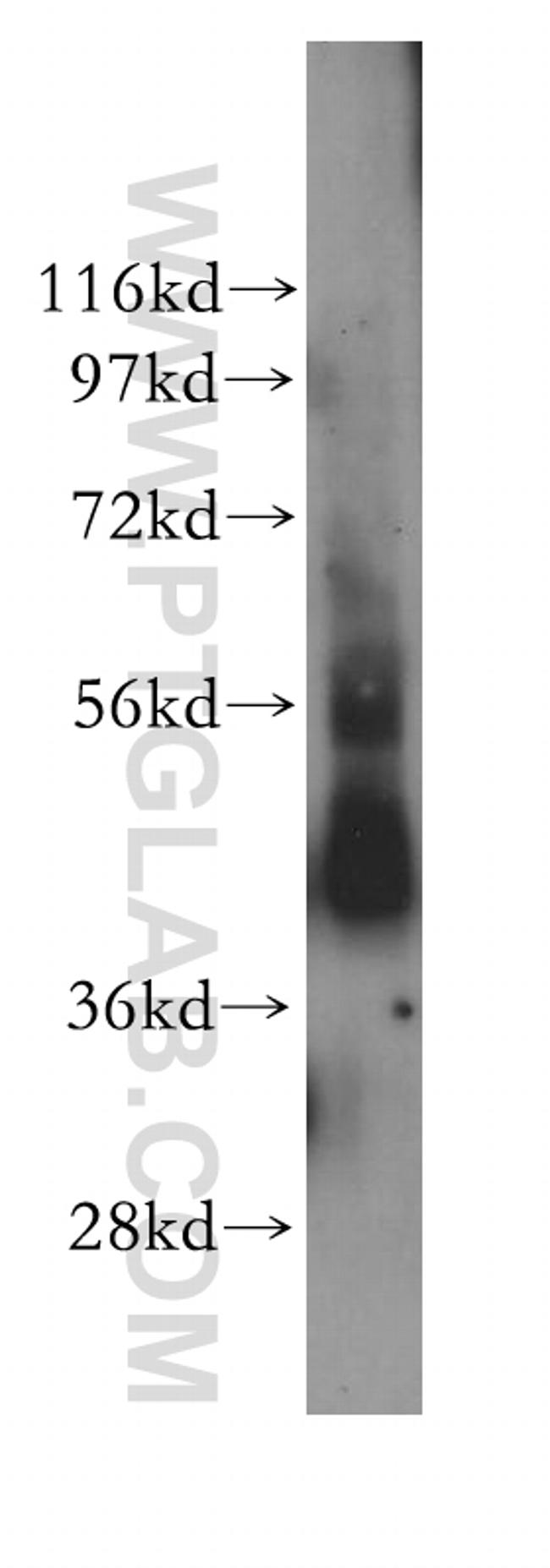 STAC Antibody in Western Blot (WB)