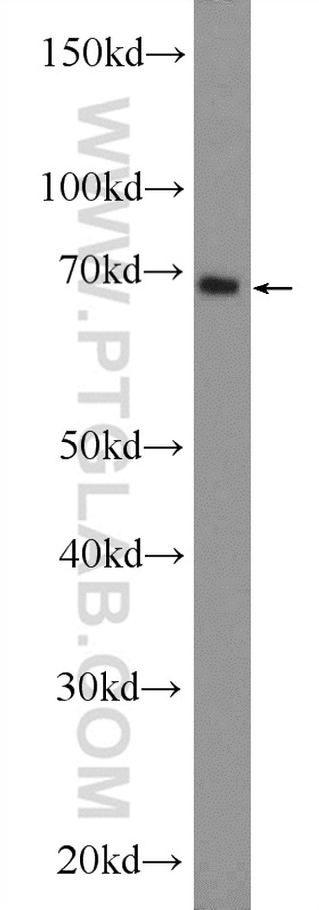 EIF3L Antibody in Western Blot (WB)