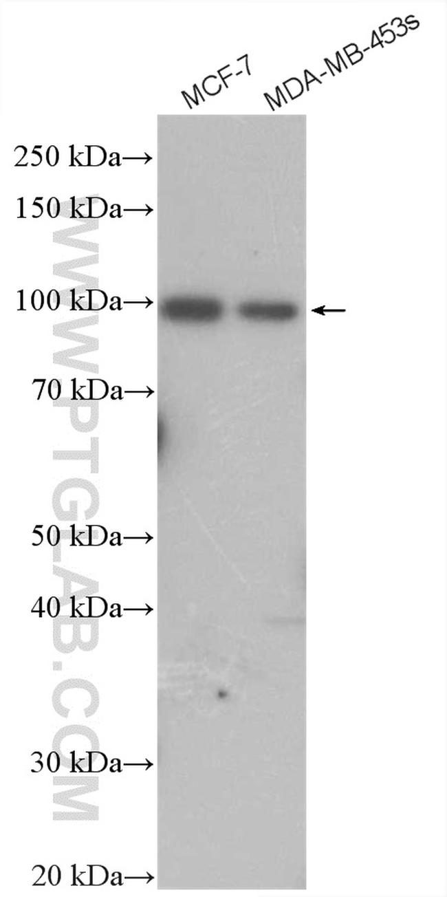 HECTD3 Antibody in Western Blot (WB)