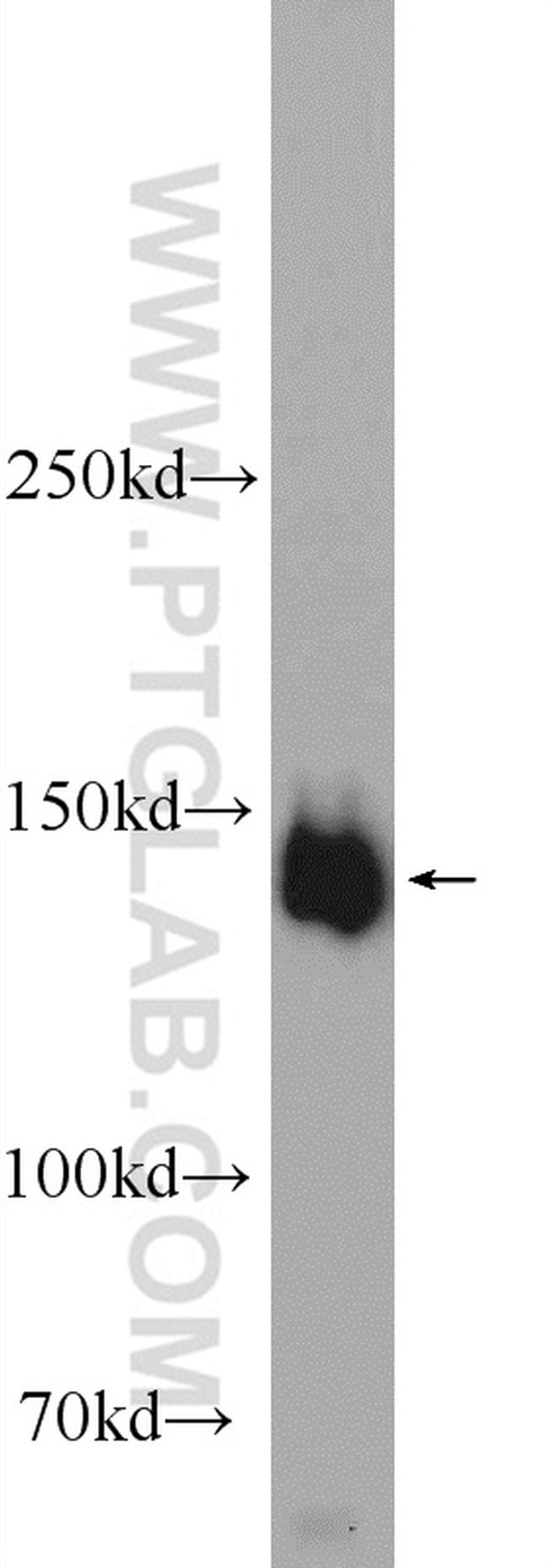 PPFIA3 Antibody in Western Blot (WB)
