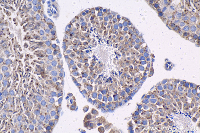 LMAN2 Antibody in Immunohistochemistry (Paraffin) (IHC (P))