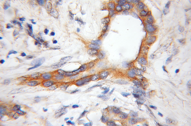COX11 Antibody in Immunohistochemistry (Paraffin) (IHC (P))