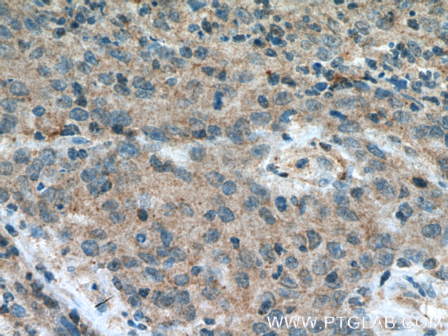 FBXW2 Antibody in Immunohistochemistry (Paraffin) (IHC (P))