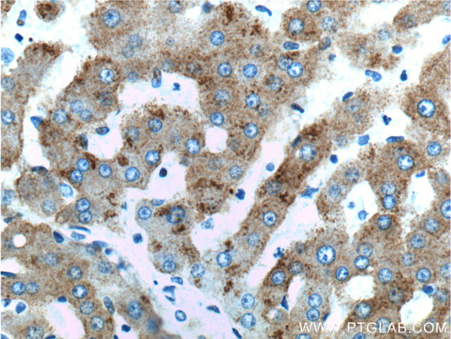 ASGR2 Antibody in Immunohistochemistry (Paraffin) (IHC (P))
