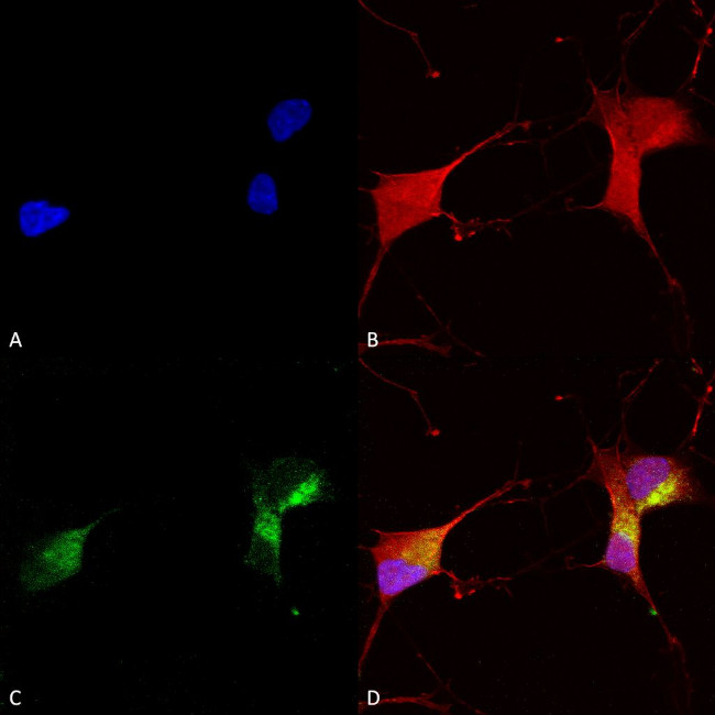 KCNQ1 K+ Channel Antibody in Immunocytochemistry (ICC/IF)