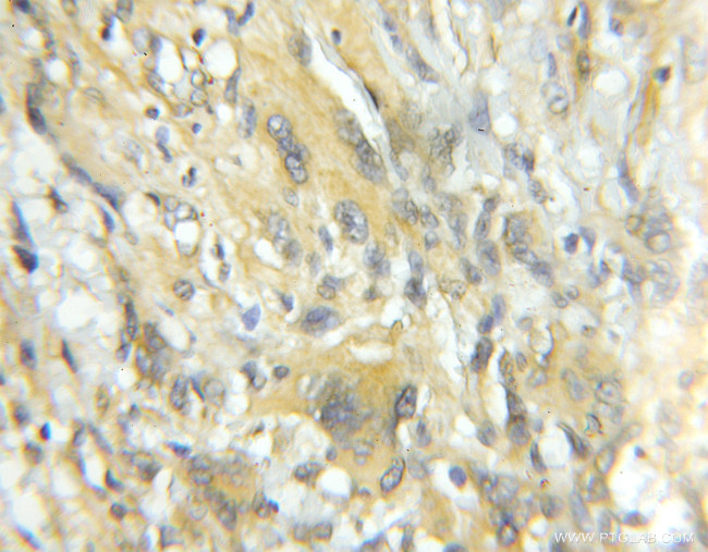 TRIM44 Antibody in Immunohistochemistry (Paraffin) (IHC (P))