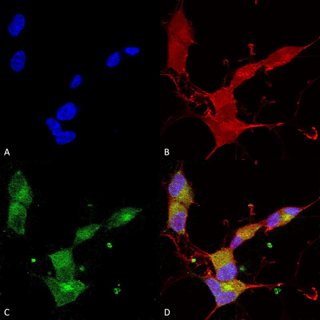 KCNQ4 K+ Channel Antibody in Immunocytochemistry (ICC/IF)