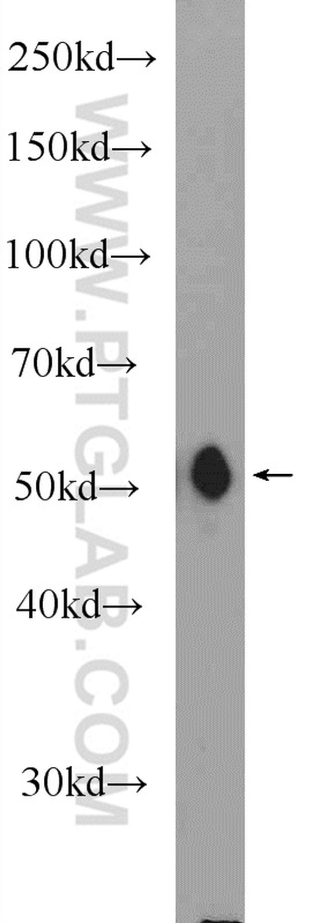 MFSD10 Antibody in Western Blot (WB)