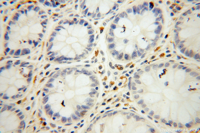 Symplekin Antibody in Immunohistochemistry (Paraffin) (IHC (P))