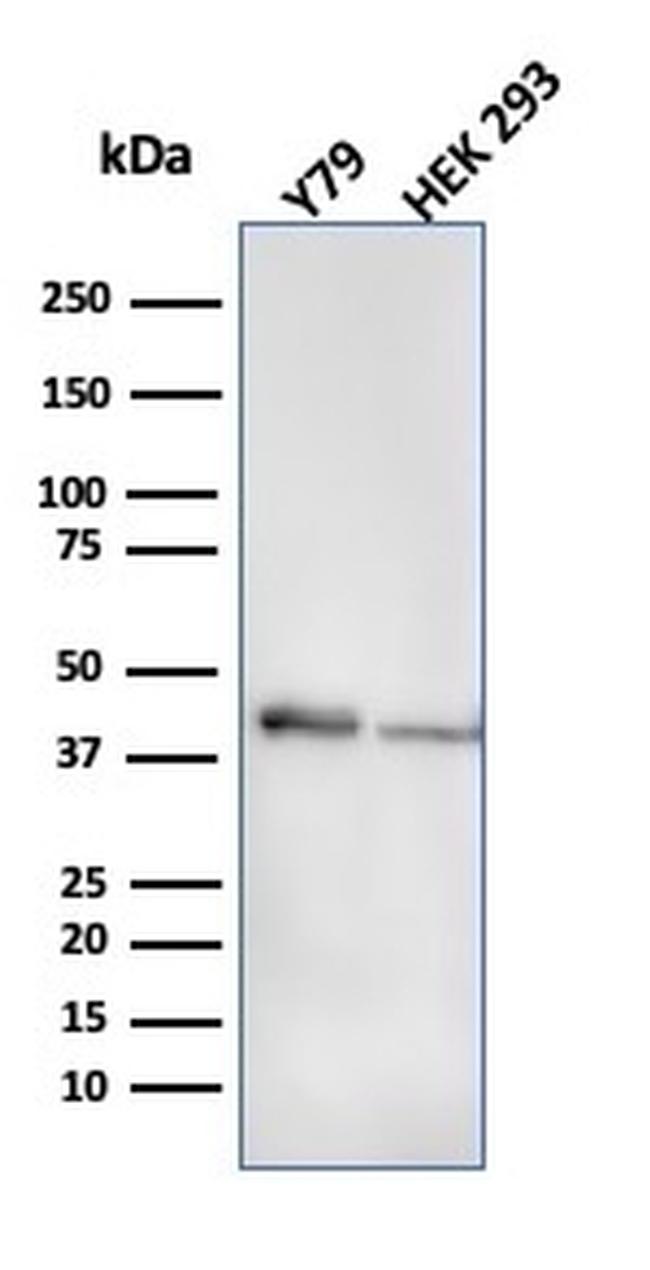Creatine Phosphokinase-BB (CK-BB) Antibody in Western Blot (WB)
