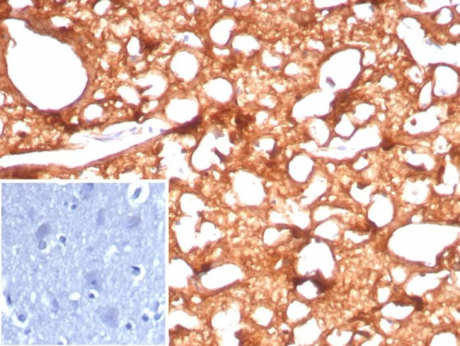 Creatine Phosphokinase-BB (CK-BB) Antibody in Immunohistochemistry (Paraffin) (IHC (P))