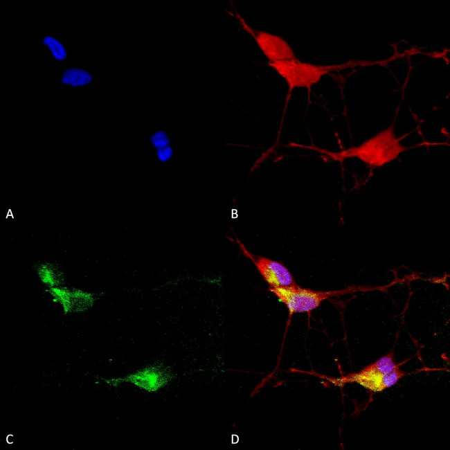 TrpV3 Cation Channel Antibody in Immunocytochemistry (ICC/IF)