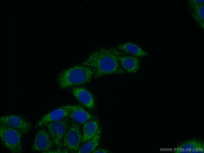 ECM1 Antibody in Immunocytochemistry (ICC/IF)
