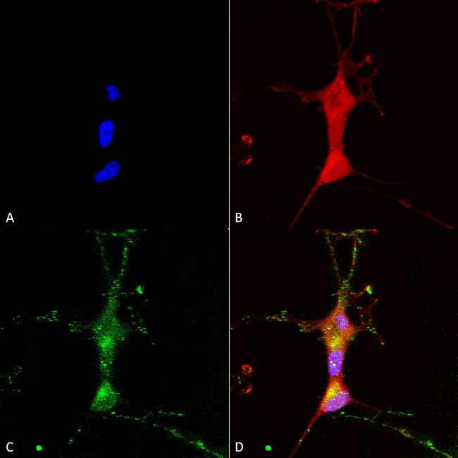 TrpC7 Ca+2 Channel Antibody in Immunocytochemistry (ICC/IF)