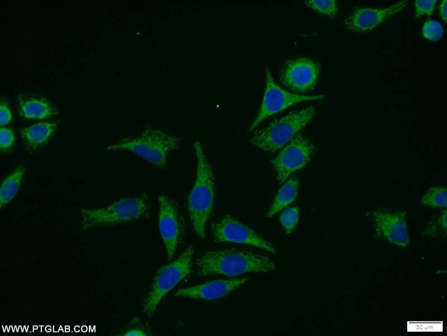MCC Antibody in Immunocytochemistry (ICC/IF)