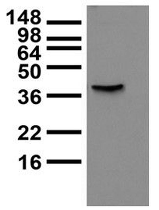 BK Beta3a K+ Channel Antibody in Western Blot (WB)