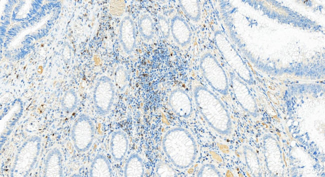 NKG7 Antibody in Immunohistochemistry (Paraffin) (IHC (P))