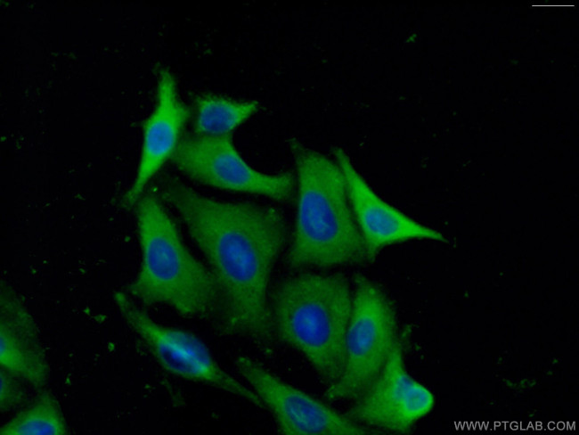 PREP Antibody in Immunocytochemistry (ICC/IF)