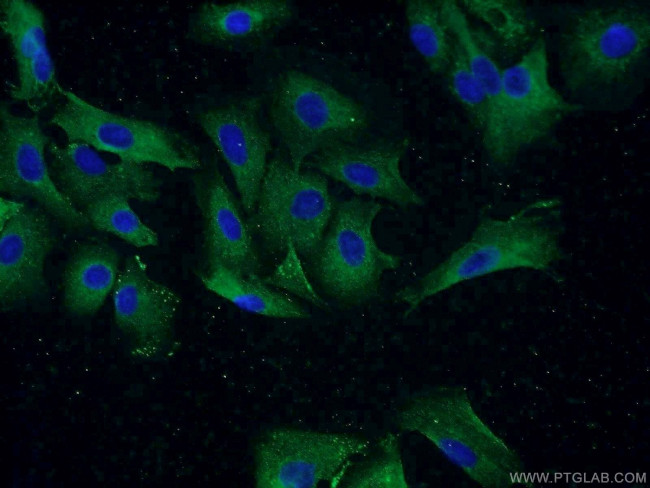 TUSC2 Antibody in Immunocytochemistry (ICC/IF)