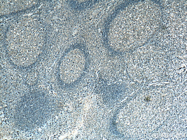 IgG light chain (lambda) Antibody in Immunohistochemistry (Paraffin) (IHC (P))
