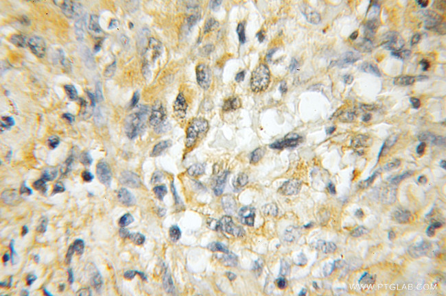 DBC1 Antibody in Immunohistochemistry (Paraffin) (IHC (P))