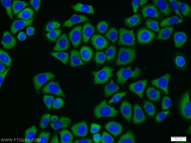 CAMKK2 Antibody in Immunocytochemistry (ICC/IF)
