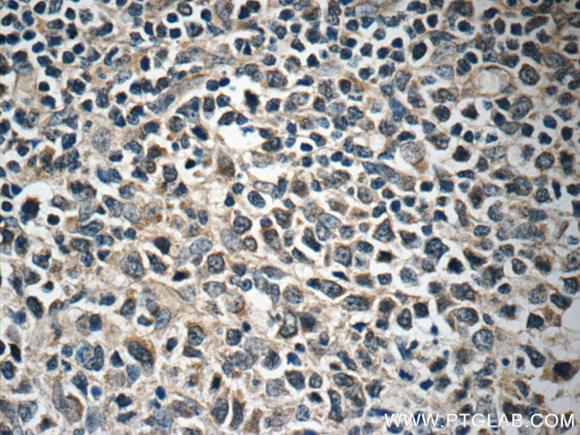 FBXL18 Antibody in Immunohistochemistry (Paraffin) (IHC (P))