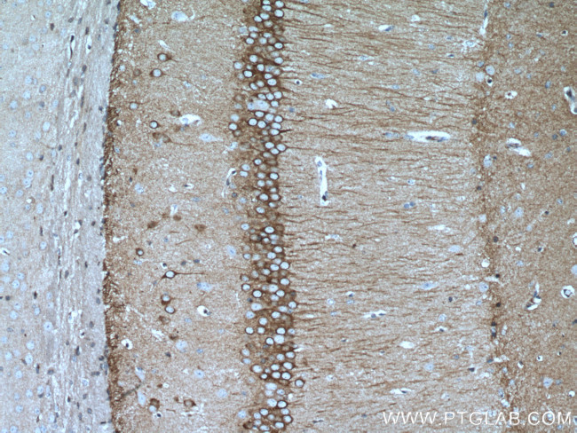 WFS1 Antibody in Immunohistochemistry (Paraffin) (IHC (P))