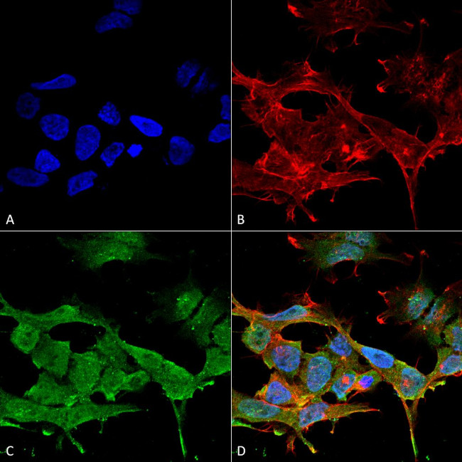 Chloride Channel Protein 3 Antibody in Immunocytochemistry (ICC/IF)
