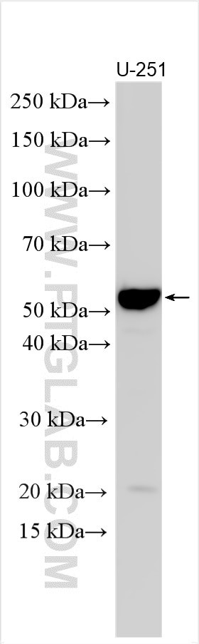 CRLF3 Antibody in Western Blot (WB)
