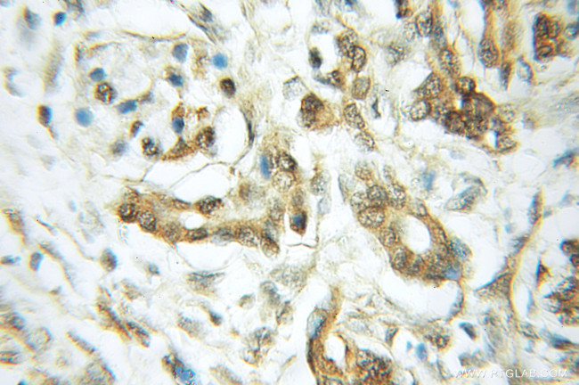 RASEF Antibody in Immunohistochemistry (Paraffin) (IHC (P))
