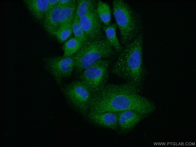 TRK fused gene Antibody in Immunocytochemistry (ICC/IF)