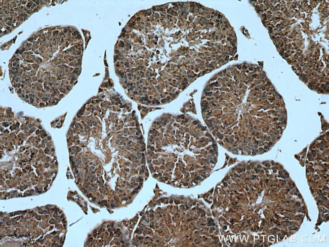 MPP6 Antibody in Immunohistochemistry (Paraffin) (IHC (P))
