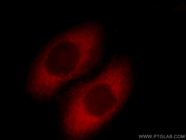 SCIN Antibody in Immunocytochemistry (ICC/IF)