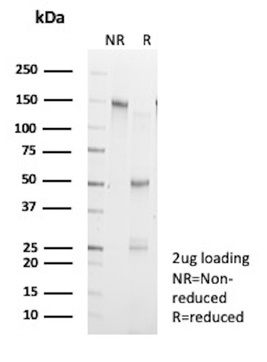Creatine Kinase MM (Biomarker for Muscular Injury & Cardiac Damage) Antibody in SDS-PAGE (SDS-PAGE)