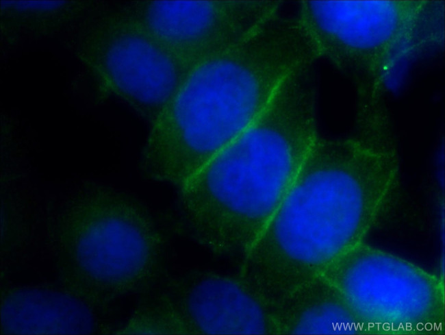 PLSCR1 Antibody in Immunocytochemistry (ICC/IF)