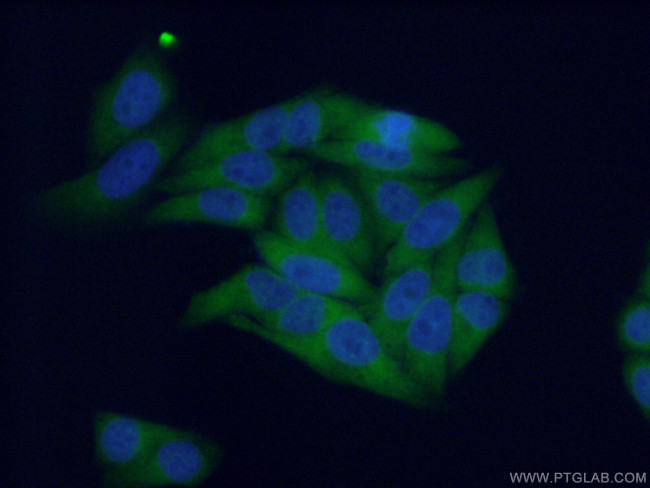 SRP68 Antibody in Immunocytochemistry (ICC/IF)