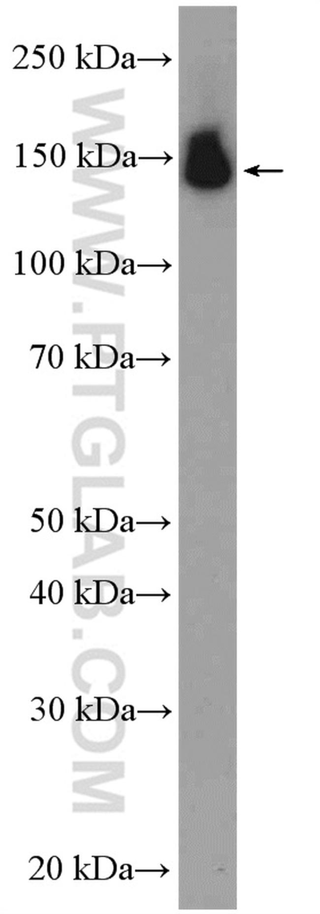 PUM2 Antibody in Western Blot (WB)