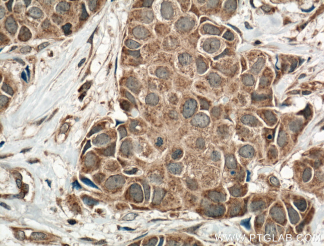 ACP5 Antibody in Immunohistochemistry (Paraffin) (IHC (P))