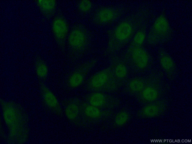 TFIIE beta Antibody in Immunocytochemistry (ICC/IF)