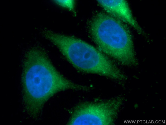 IFI30 Antibody in Immunocytochemistry (ICC/IF)