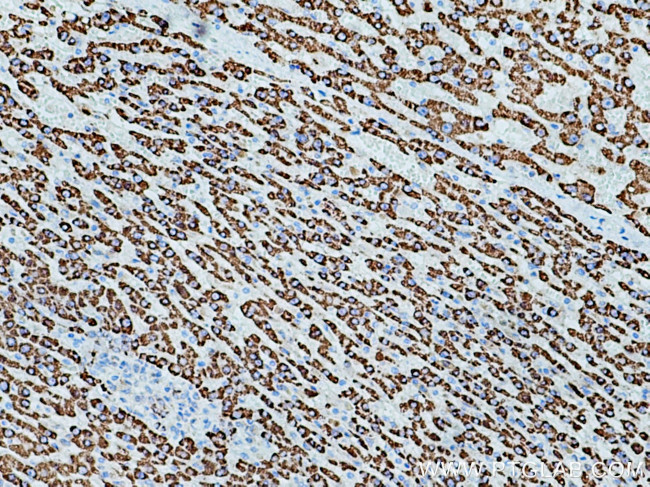 ALDH4A1 Antibody in Immunohistochemistry (Paraffin) (IHC (P))