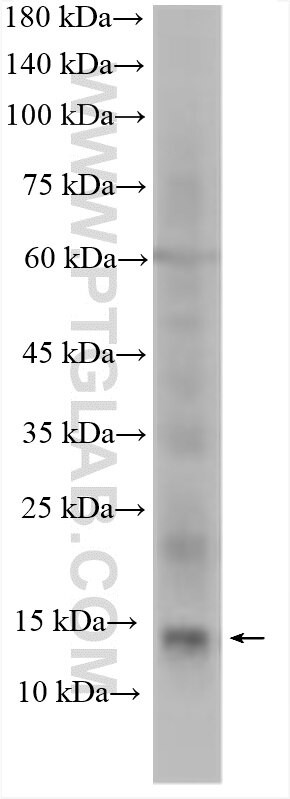 TAC3 Antibody in Western Blot (WB)